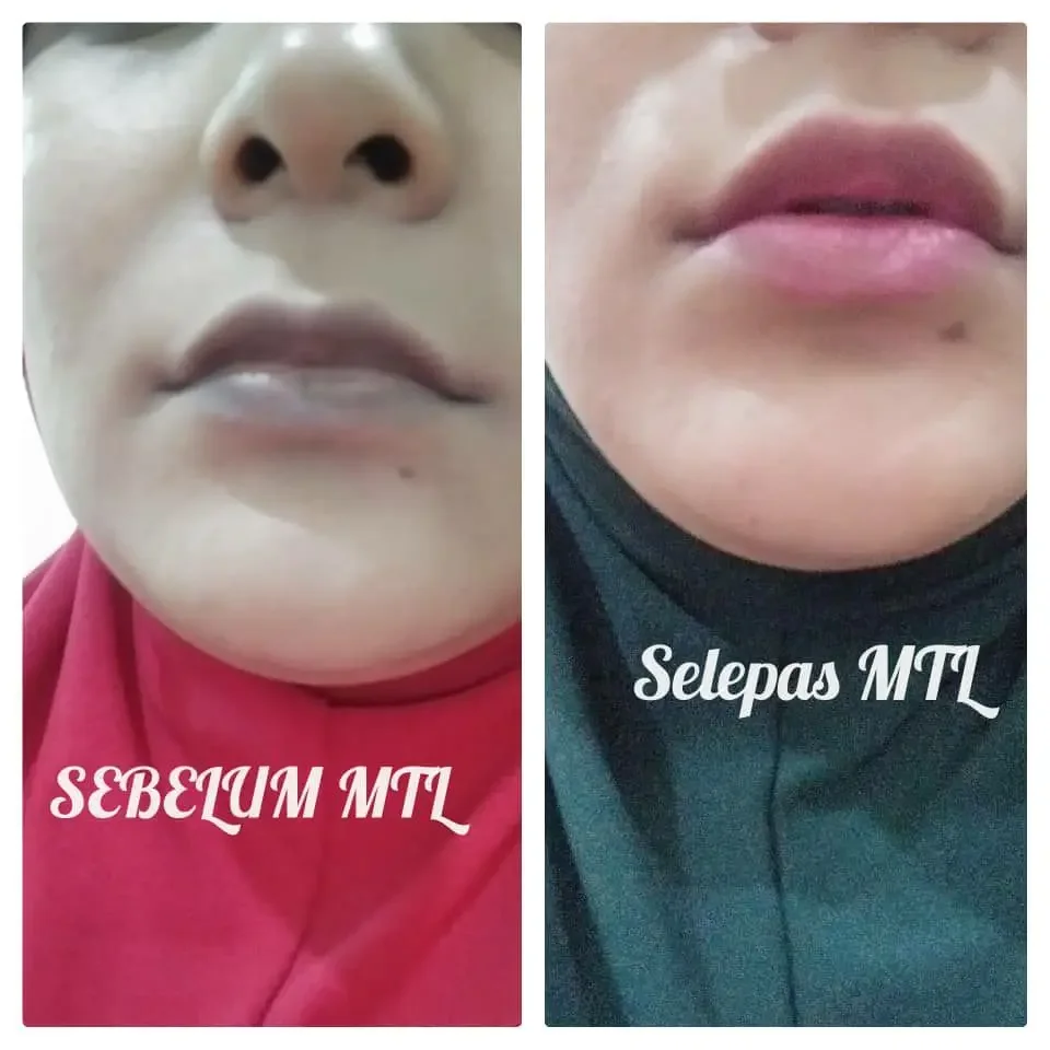 unisex Lipbalm bibir hitam kering luka sensitif perokok