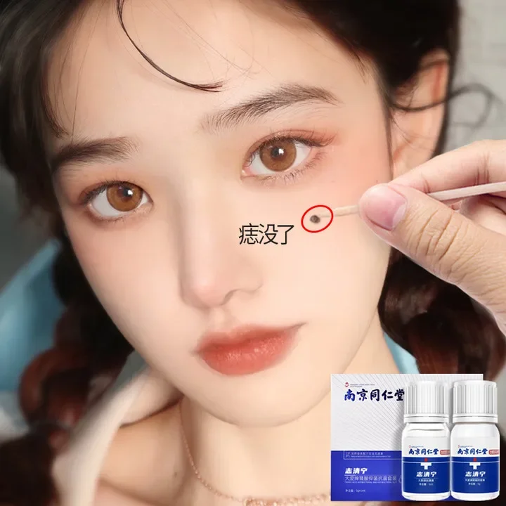 [Nanjing Tongrentang Zhiqingning] Traceless Remove Mole Spots on the Face Mole Removal Artifact Buy One Get Four
