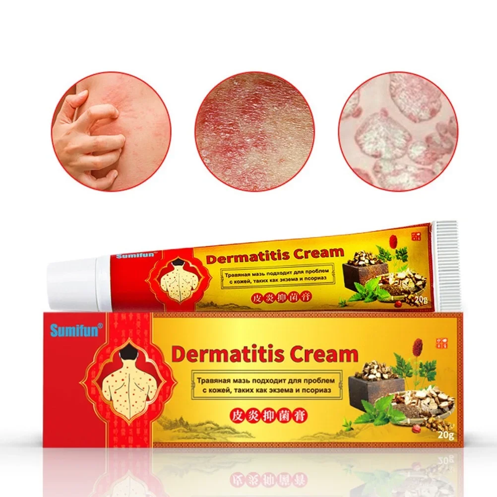 Krim Herba Psoriasis Dan Eczema Ointment/ Skin Care Cream Herbal Psoriasis Cream Dermatitis Eczematoid Eczema Ointment