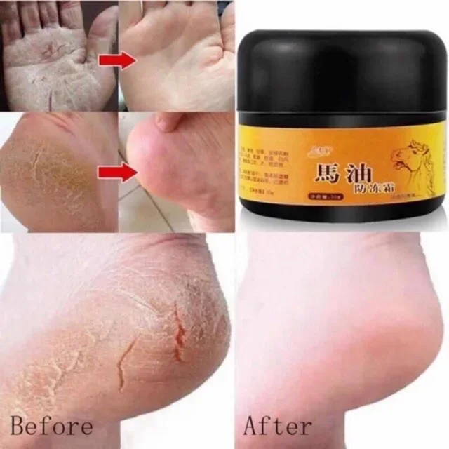 Horse Oils Foot Cream Anti-Chapping Skin Repairing Moisturizer Feet Heel 马油防冻霜
