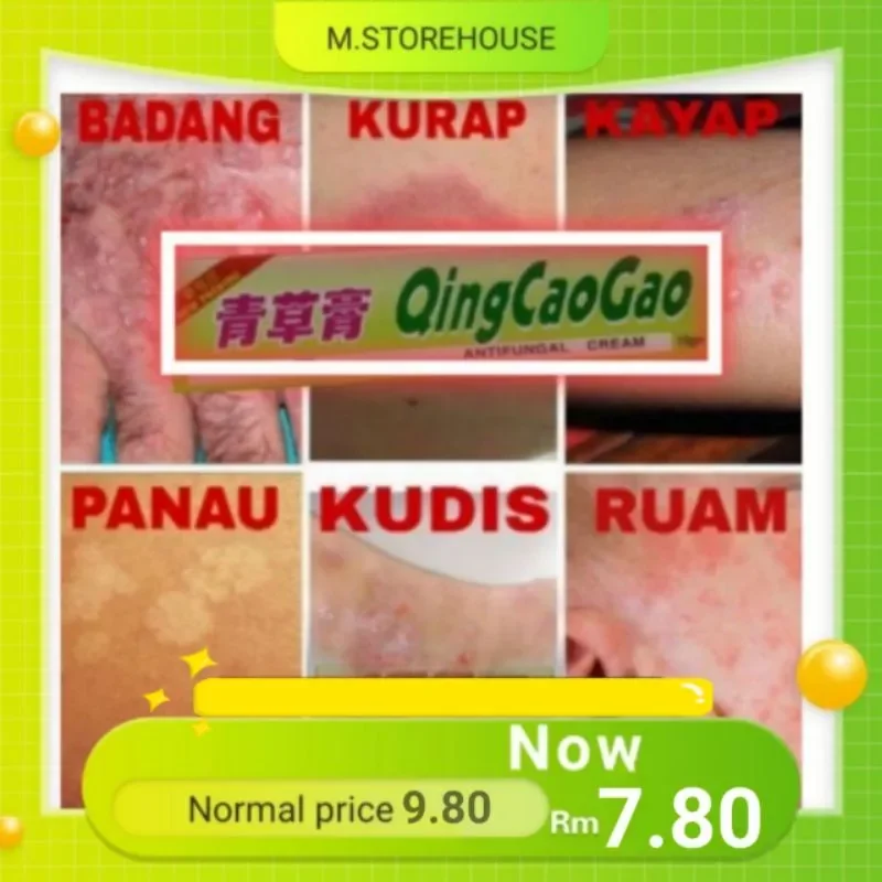 青草膏(乳膏) Qing Cao Gao 15gm Original | Lazada