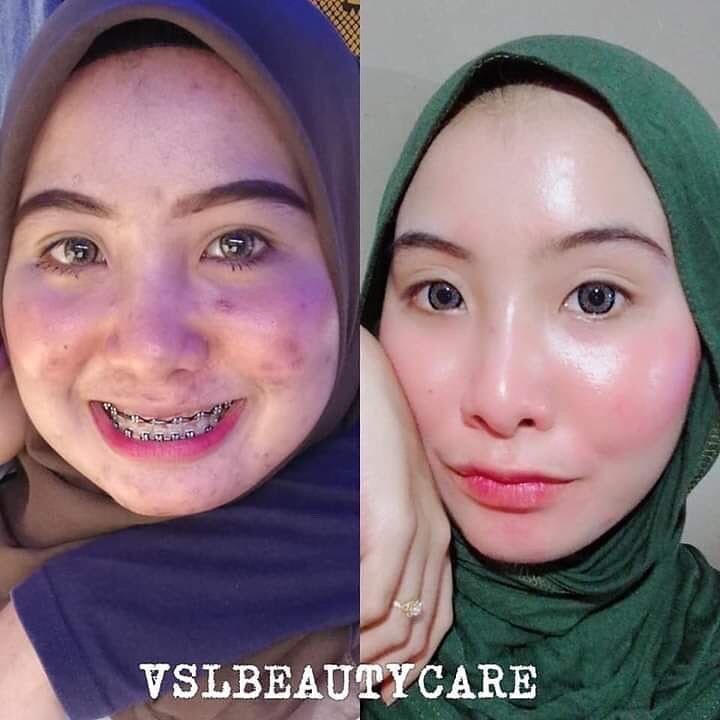 Night Cream By Vsl Beauty Care Lazada