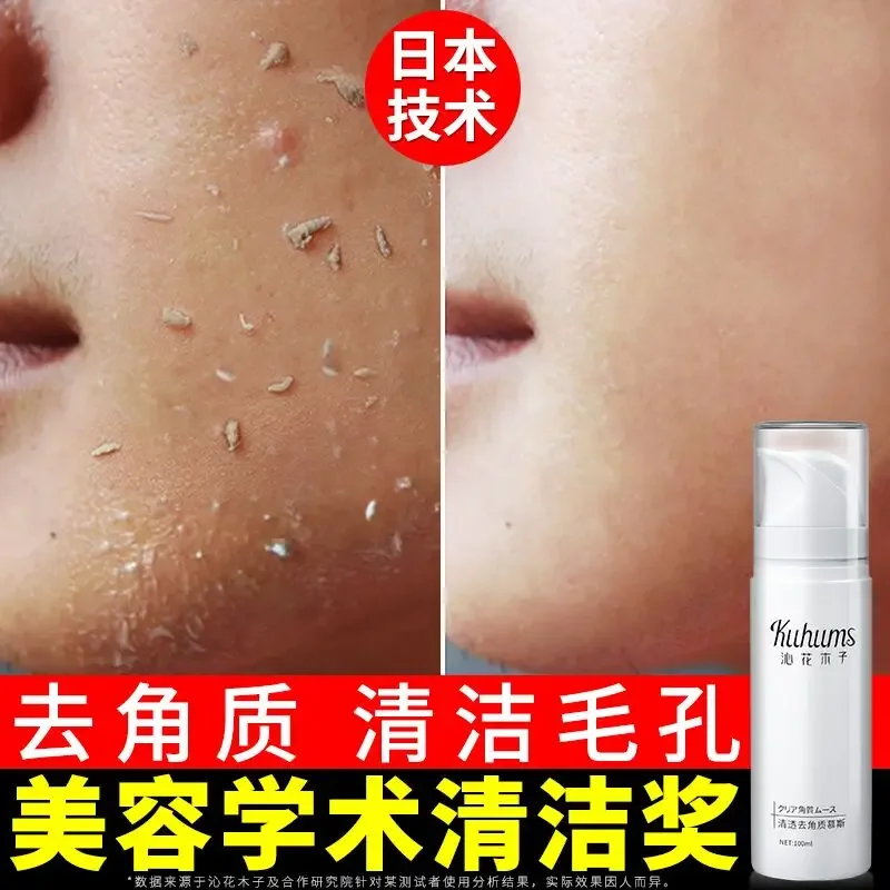Japanese Exfoliating Mousse Cleansing Facial Female Male Facial Exfoliating Blackhead Mites Shrink Pores Deep Cleansing