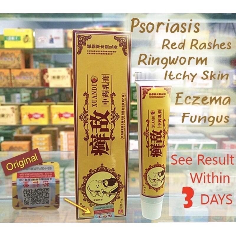 XUANDI Krim Kurap Kudis Psiorasis Ekzema Panau Fungus Gatal Cream
