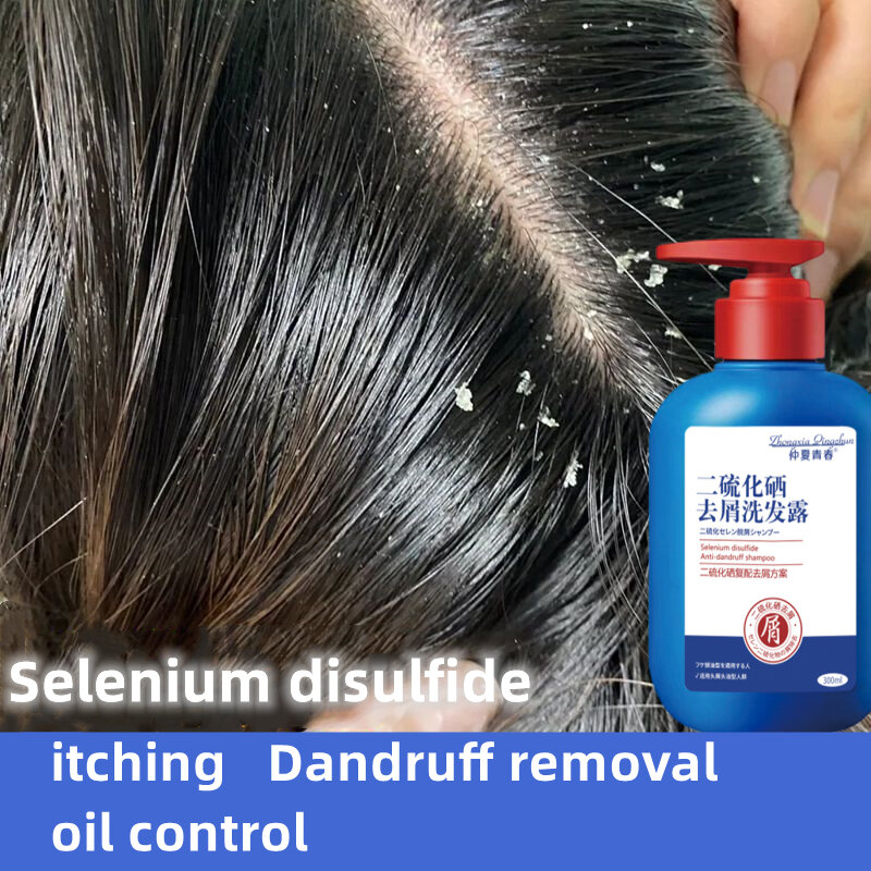 Happy%20day%20anti%20dandruff%20shampoo%20300ml%20dandruff%20treatment%20oil%20control%20sea%20salt%20Shampoo%20syampoo%20kelemumur%20syampu%20Relieve%20itchy%20scalp%20Bald%20Deep%20clean%20scalp%20reduce%20dandruff%20hair%20treatment%20removes%20mites%20Scalp%20Care%20scalp%20psoriasis%20%E4%BA%8C%E7%A1%AB%E5%8C%96%E7%A1%92%E5%8E%BB%E5%B1%91%E6%B4%97%E5%8F%91%E6%B0%B4%20-%20Image%205