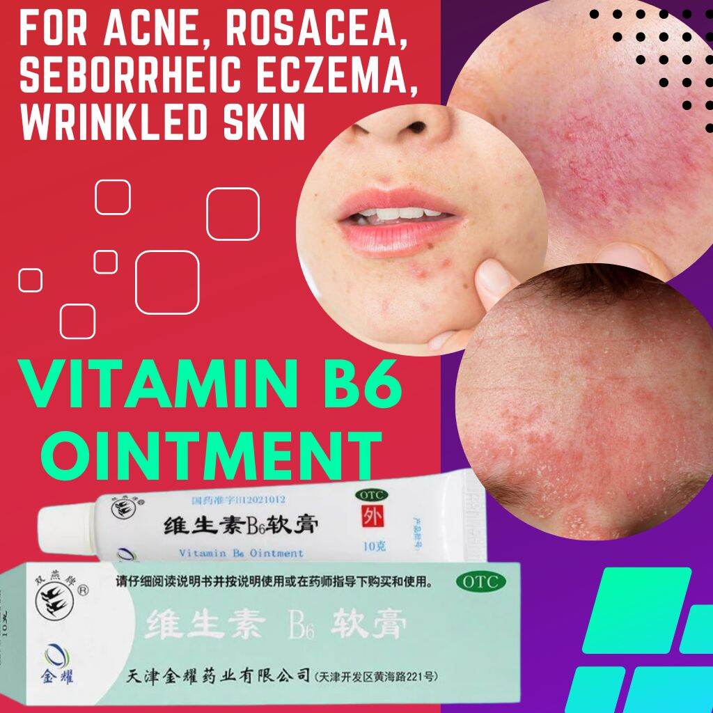 Vitamin B6 Ointment 维生素B6软膏10g 痤疮酒渣鼻脂溢性湿疹皱皮症痘痘 acne rosacea seborrheic eczema wrinkle acne Lazada