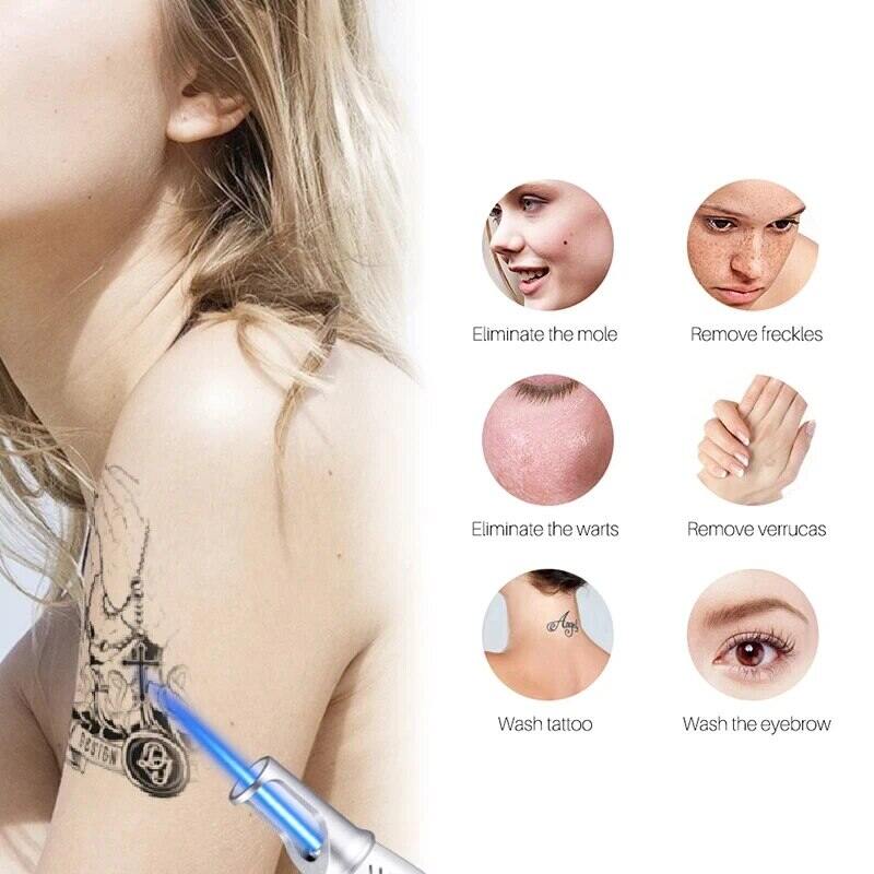 Picosecond Laser Pointer for Mole Dark Spot Pen Tatuering Akne Hudpigment Bärbar borttagning hine Beauty Device_voghion.com