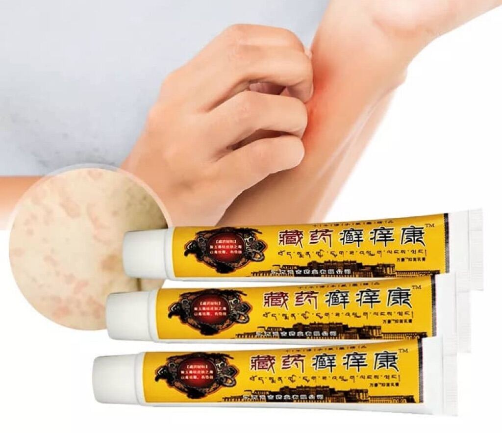 1pcs 20g Psoriasis Antipruritic Ointment Herbal Antibacterial Cream