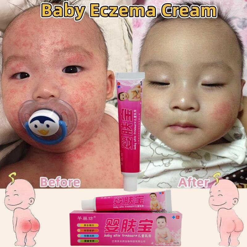 Nappy cream baby Ubat ruam baby Eczema cream Nappy rash cream krim - Main Image