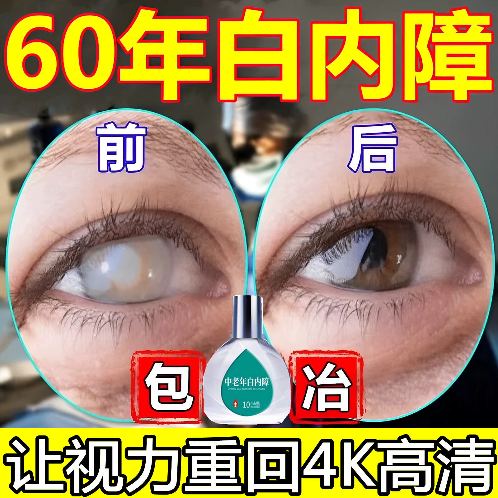 MiddleAged and Elderly Cataract Eye Drops Japan Eye Drops Kaxing Old