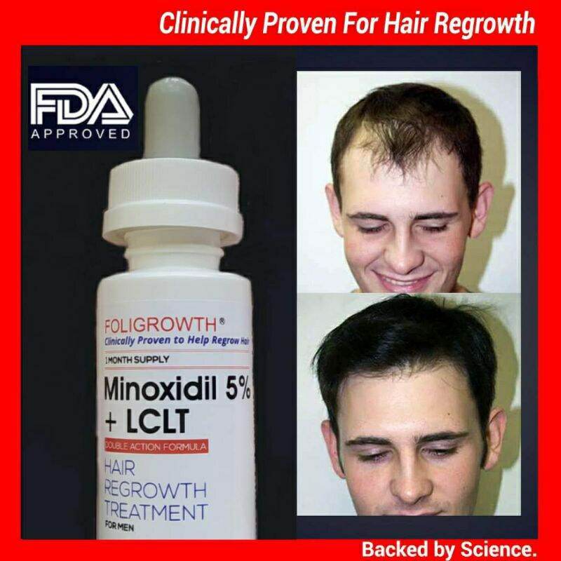 Gambar ??Minoxidill 5% + LCLT | FOLIGROWTH | Advance Hair Beard growth treatment | Original USA