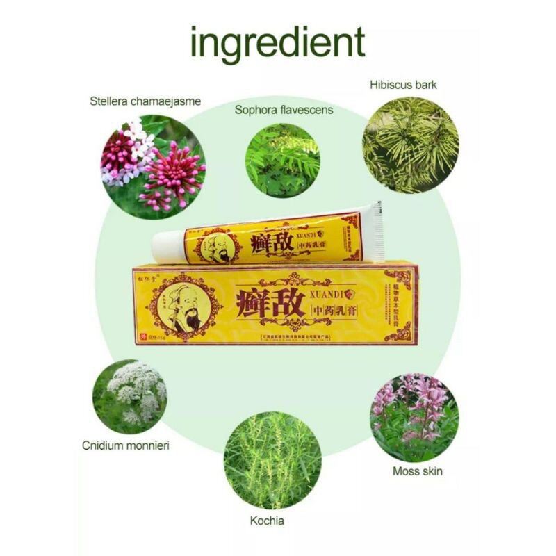 Psoriasis Cream Eczema Herbal Cream Works Perfect For Skin Problems