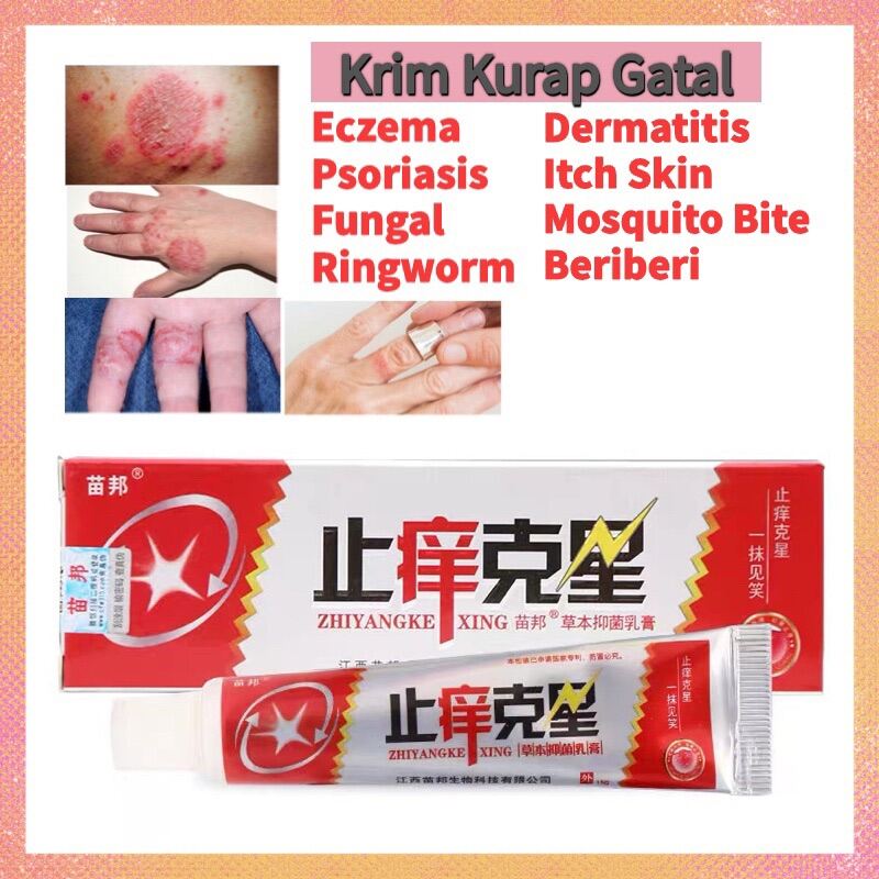 Eczema Psoriasis Fungal Dermatitis Beriberi Itchy Skin Treatment Cream