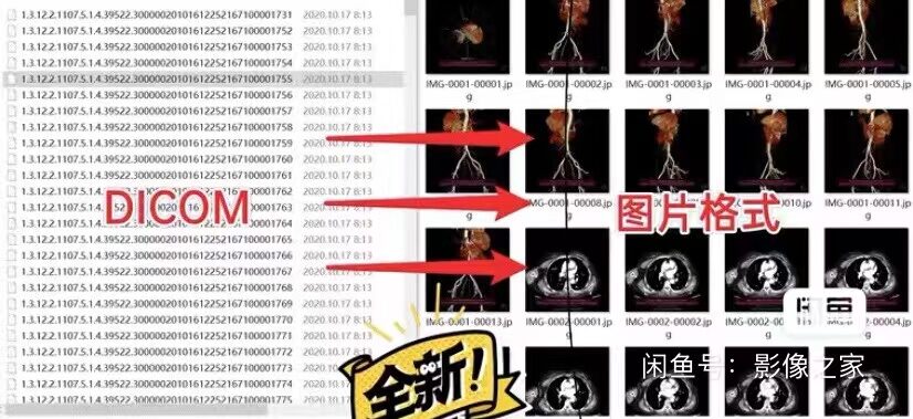 CT Image Data DICOM Format Conversion Picture Format Service Film Photography Accessories Rapid Development Film - Jenama N/A Harga 19 Ringgit*Penghantaran Percuma