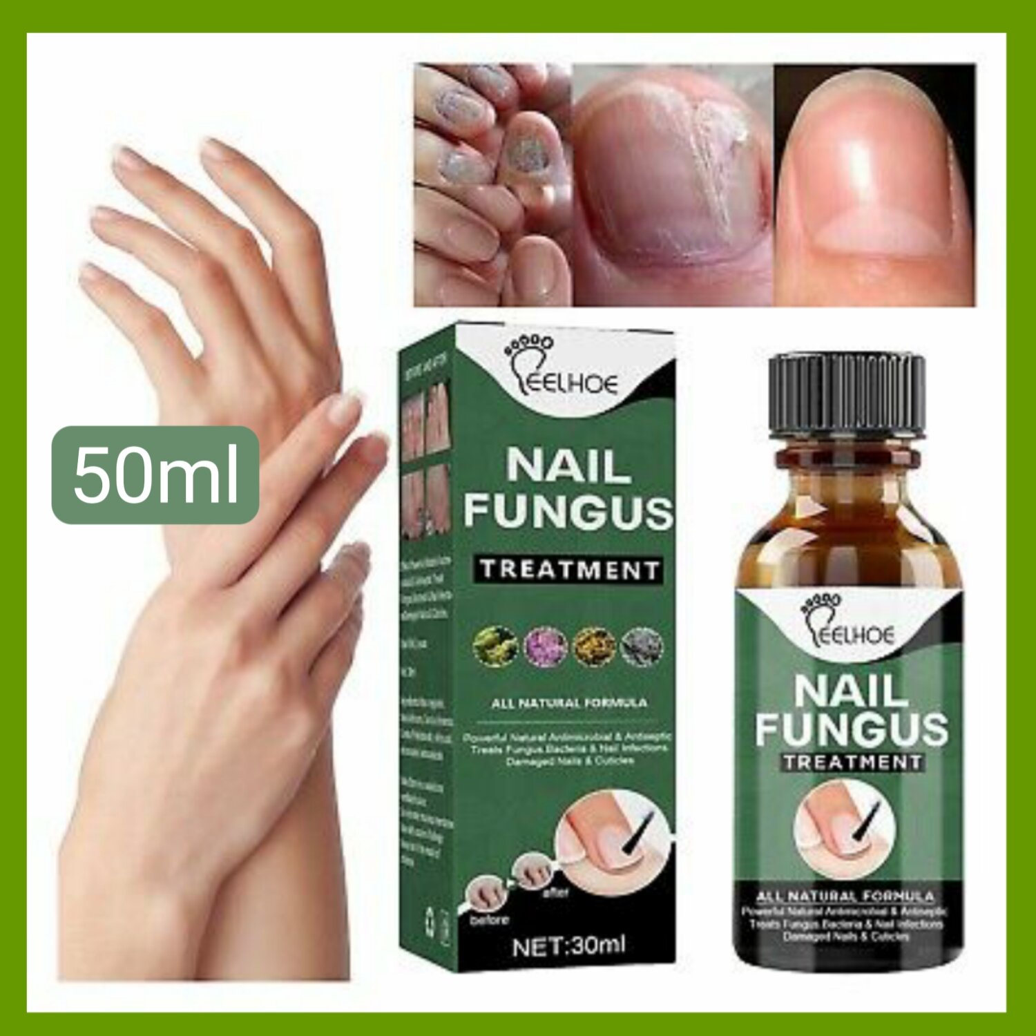 (Local Seller) 50ml Eelhoe Herbaceous Nails Repairing Serum ...