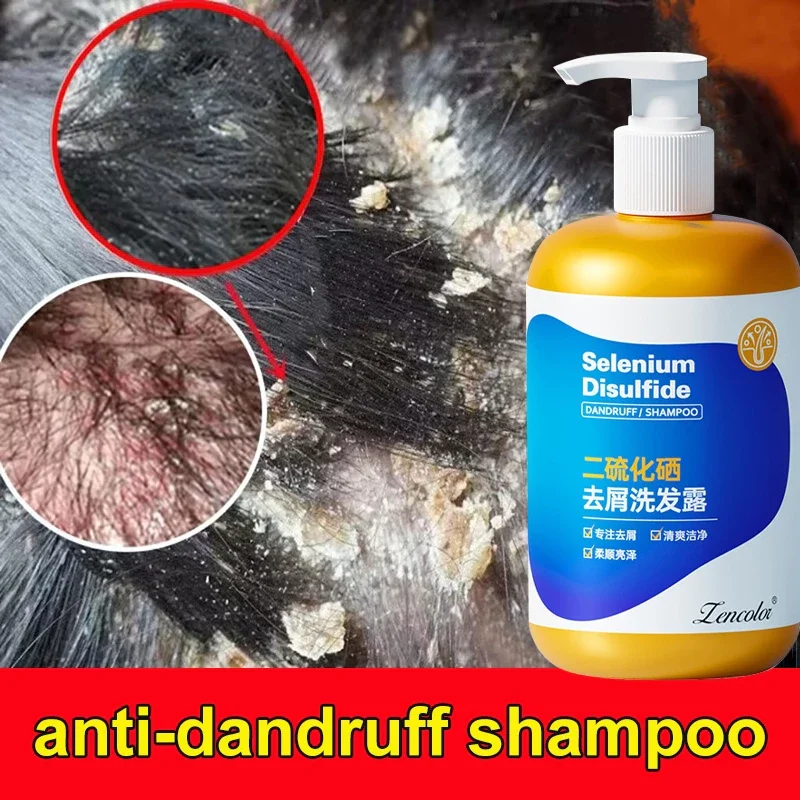 二硫化硒去屑洗发水🇲🇾Selenium disulfide anti-dandruff shampoo | Lazada