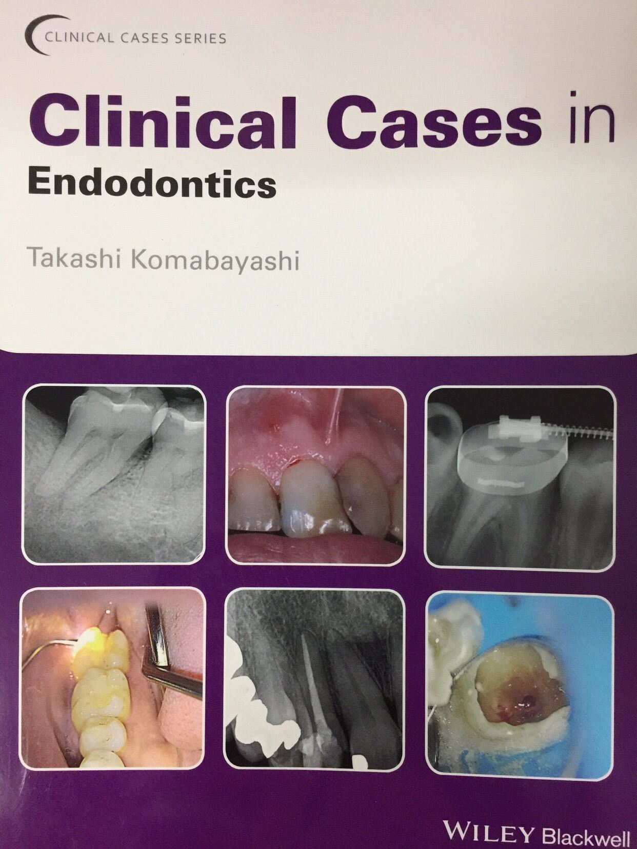 Clinical Cases in Endodontics Lazada